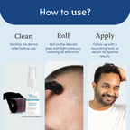 Man Matters Derma Roller 1.00 mm With 540 Titanium Alloy Needles - Promotes Beard Growth & Reduces Acne Scars | Grocsy