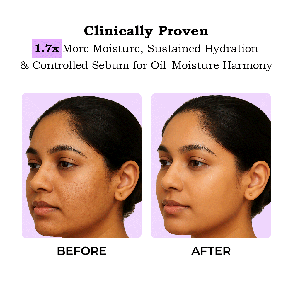 TYC Ceramide Moisturizer | Grocsy