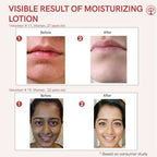 Ivory Natural Moisturizing Lotion Nourishes, Hydrates, And Revitalizes Dry Skin For Radiant Glow | Grocsy