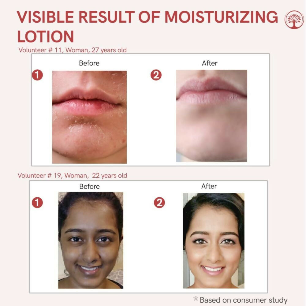 Ivory Natural Moisturizing Lotion Nourishes, Hydrates, And Revitalizes Dry Skin For Radiant Glow | Grocsy