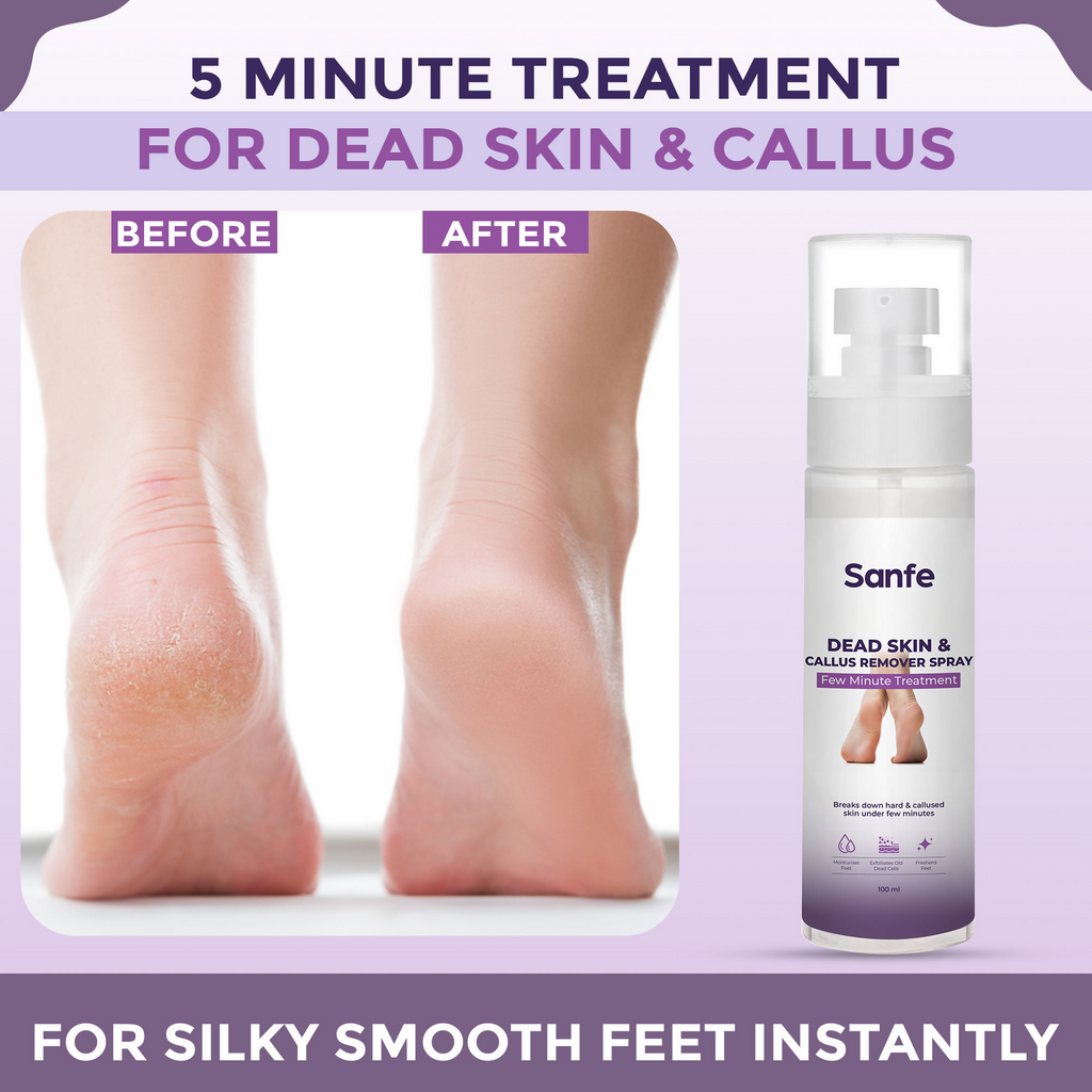 Sanfe Dead Skin & Callus Remover Spray | Grocsy