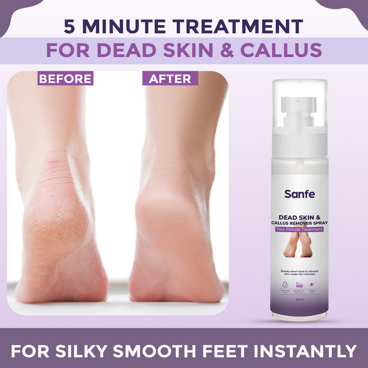 Sanfe Dead Skin & Callus Remover Spray | Grocsy