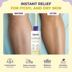 Sanfe 15% Glycerine Lotion For Very Very Dry Skin | Grocsy
