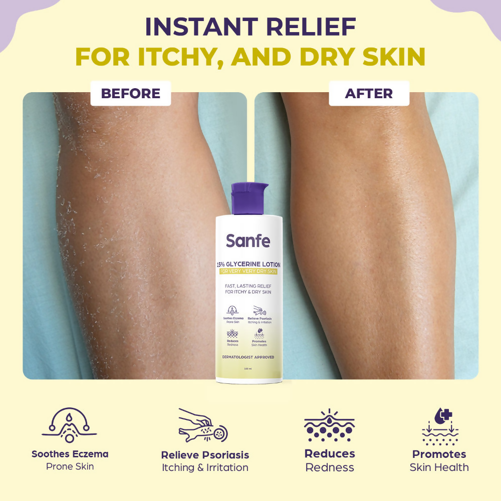 Sanfe 15% Glycerine Lotion For Very Very Dry Skin | Grocsy