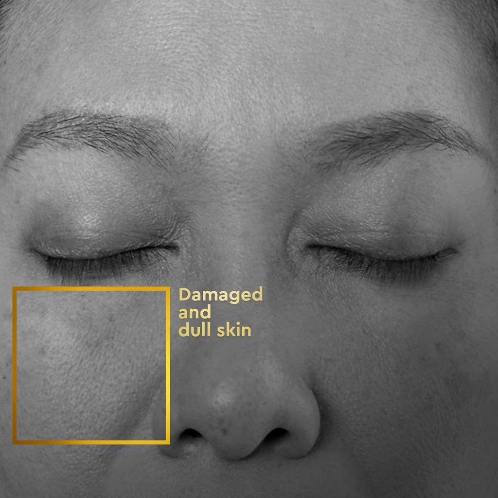 VLCC Clinic ProRescue Bio Cream | Grocsy