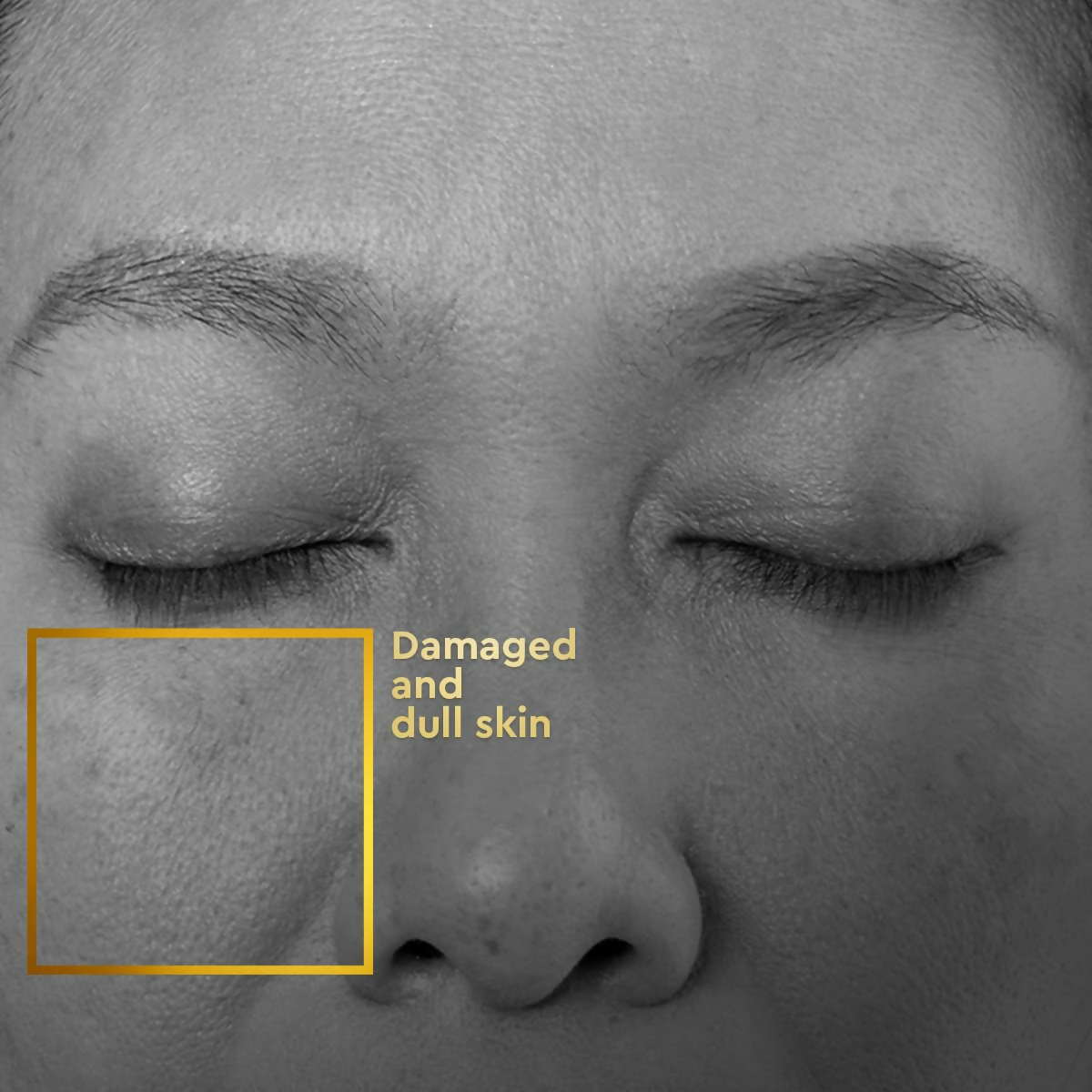 VLCC Clinic ProRescue Bio Cream | Grocsy