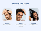 Man Matters Advanced Hair Growth Rosemary Serum Roll-On | Grocsy