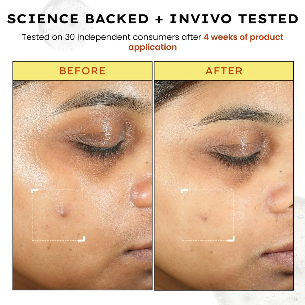 Hyphen By Kriti Sanon 10% Vitamin C, 1% Vitamin E & Ferulic Acid Serum | Grocsy