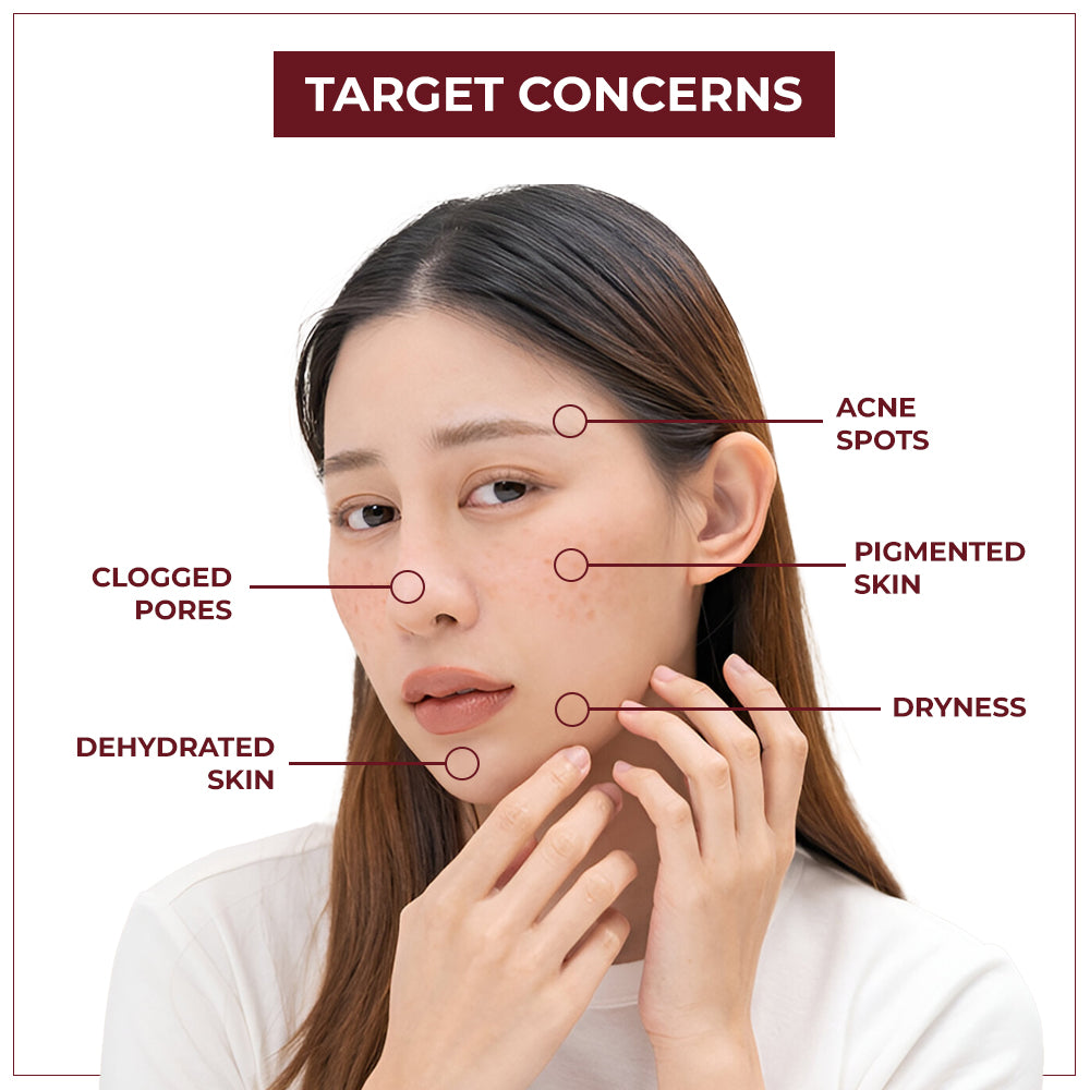 TYC Depigmentation Gel with 4% AHA For Men and Women | Grocsy