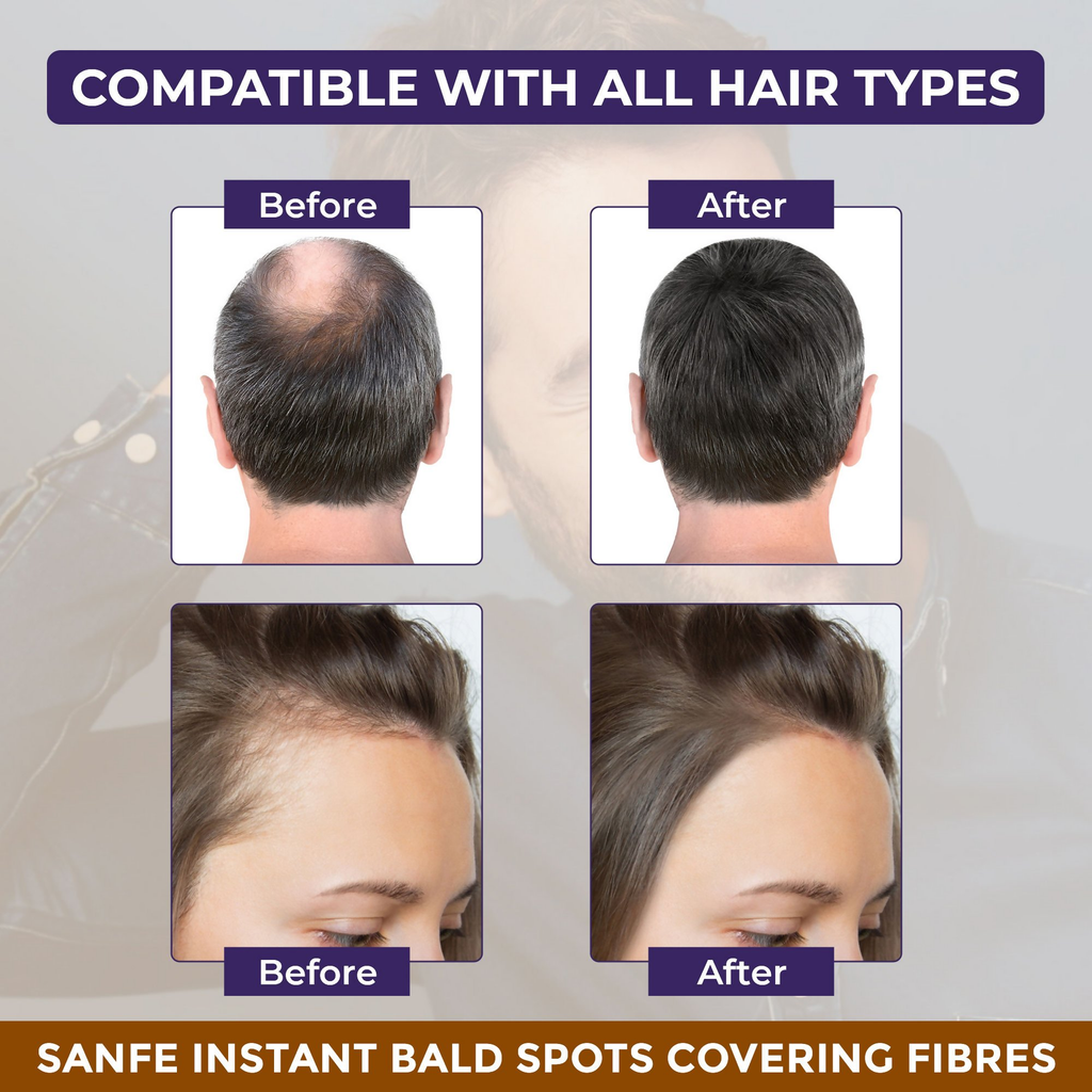 Sanfe Hair Building Fibers | Grocsy