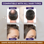 Sanfe Hair Building Fibers | Grocsy