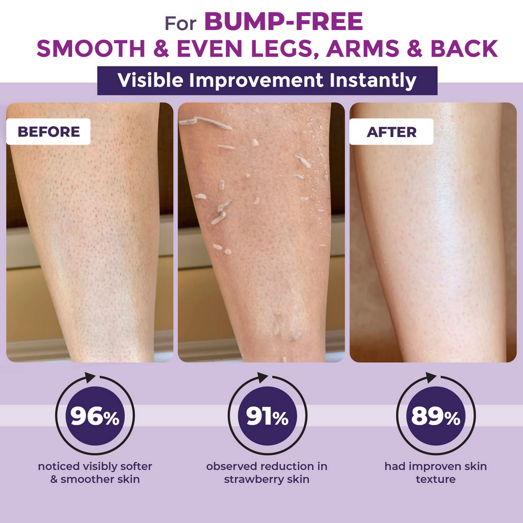 Sanfe Instant Bumps Eraser Exfoliating Gel | Grocsy