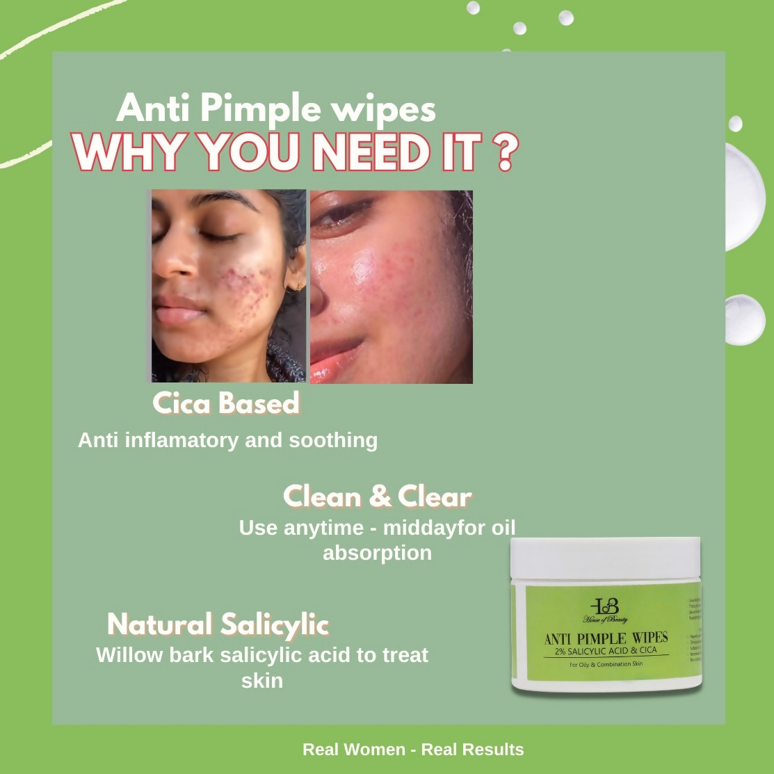House of Beauty Anti Pimple Wipes | Grocsy