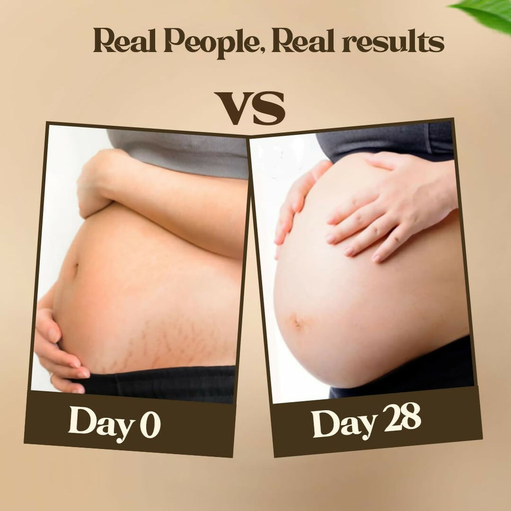 Pokonut Natural Stretch Mark Cream | Grocsy