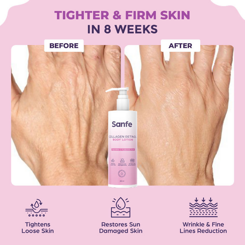 Sanfe Collagen Retinol Body Lotion | Grocsy
