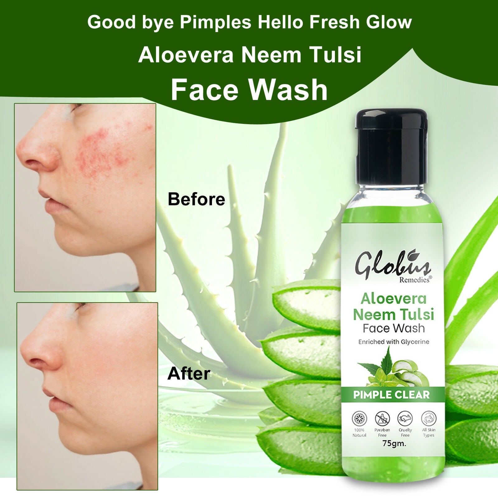 Globus Remedies Aloe vera Neem Tulsi Enriched With Glycerin & Oil Control Formula | Grocsy