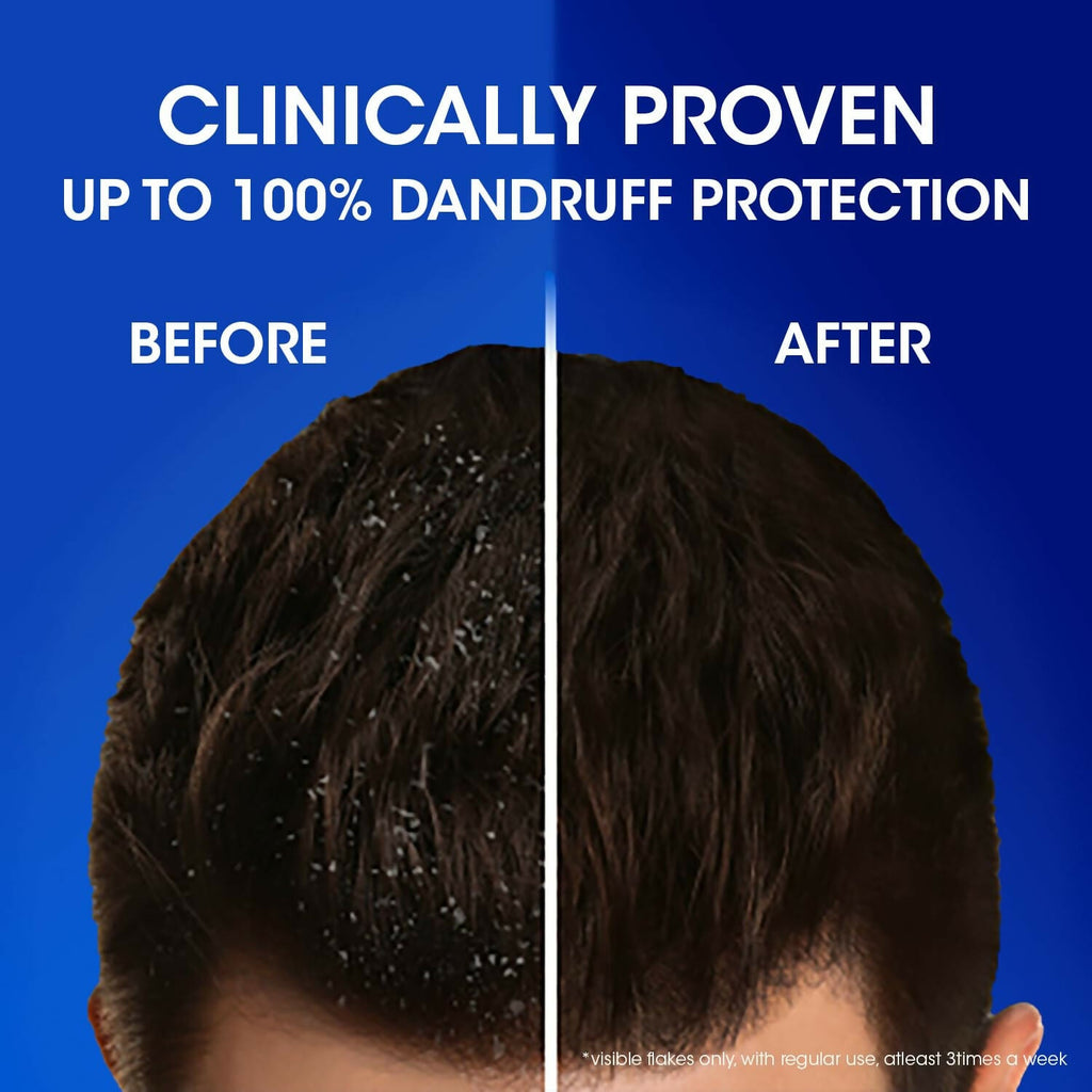 Head & Shoulders Silky Black Anti Dandruff Shampoo | Grocsy