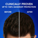 Head & Shoulders Silky Black Anti Dandruff Shampoo | Grocsy