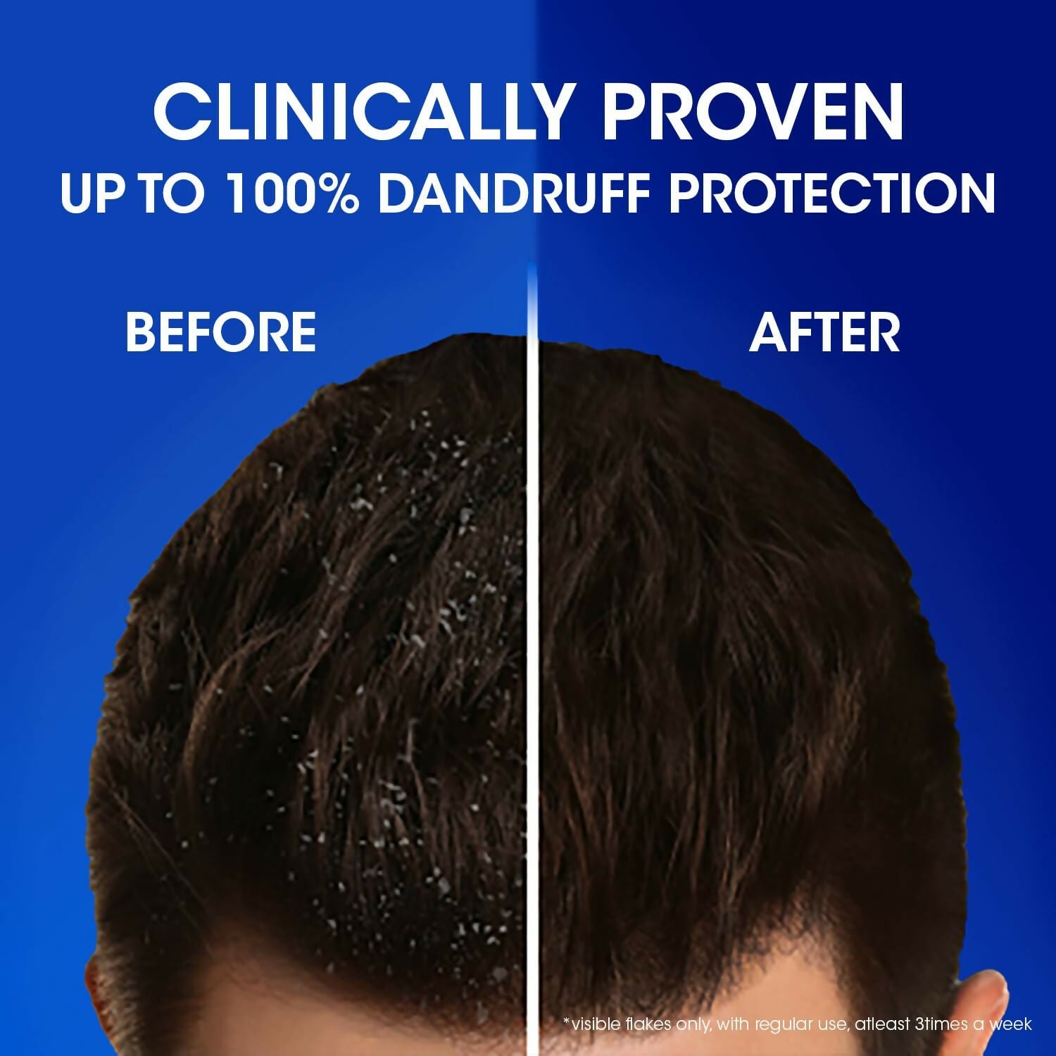 Head & Shoulders Silky Black Anti Dandruff Shampoo | Grocsy