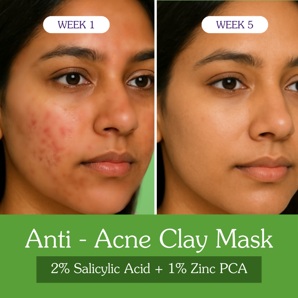 Bake 2% Salicylic Acid + Zinc PCA Anti-Acne Clay Mask - Combo | Grocsy