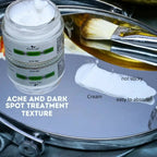 The Wellness Shop Acne and Dark Spot Treatment Cream | Grocsy