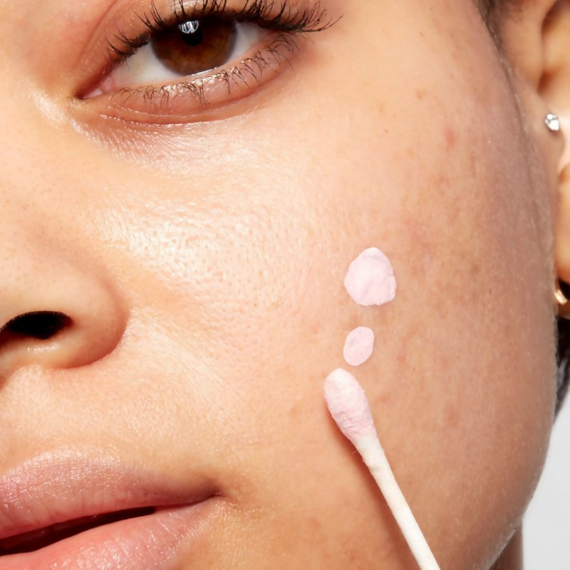 Mario Badescu Acne Spot Corrector Drying Lotion with Salicylic Acid | Grocsy