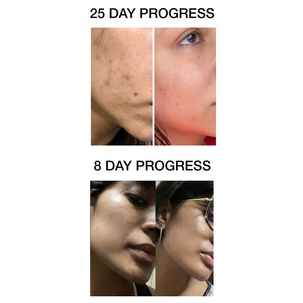 Skog Clarifying And Brightening Serum | Grocsy
