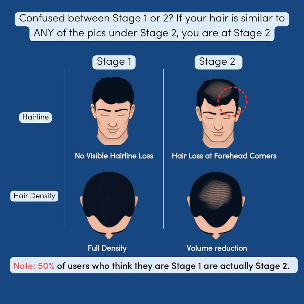 Man Matters Stage 1 Hairloss Kit for Scalp Health - Biotin Hair Gummies & DHT blocking Shampoo | Grocsy