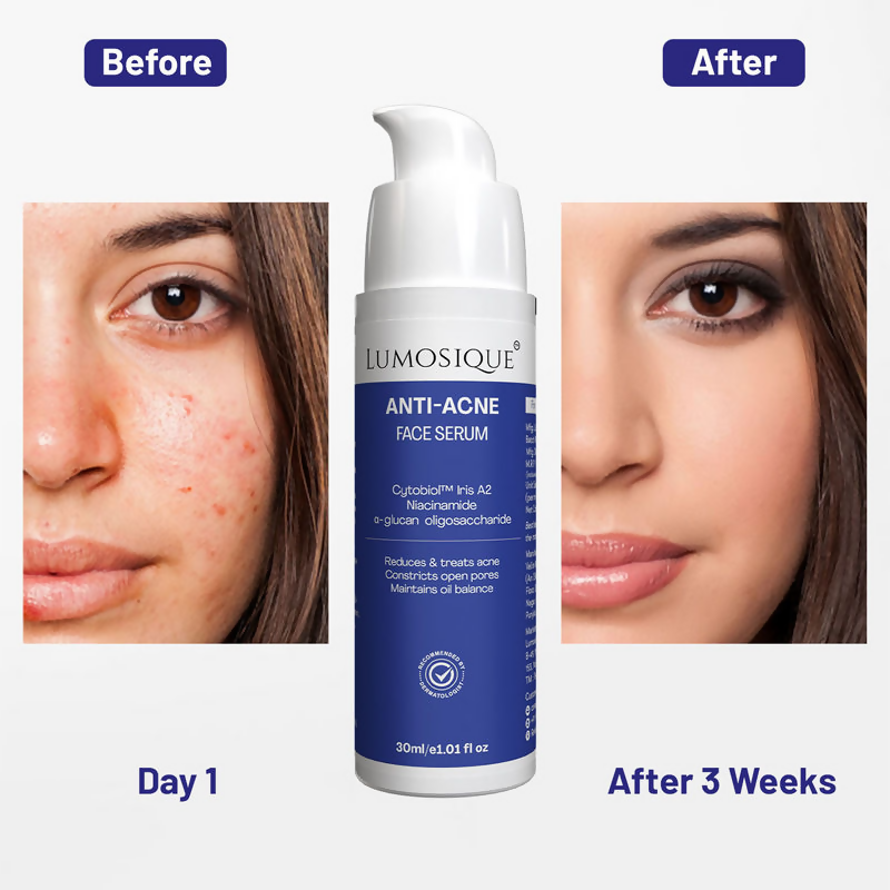 Lumosique Anti Acne Face Serum | Grocsy