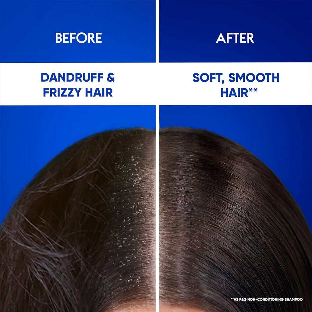 Head & Shoulders 2-in-1 Cool Menthol Anti Dandruff Shampoo + Conditioner | Grocsy