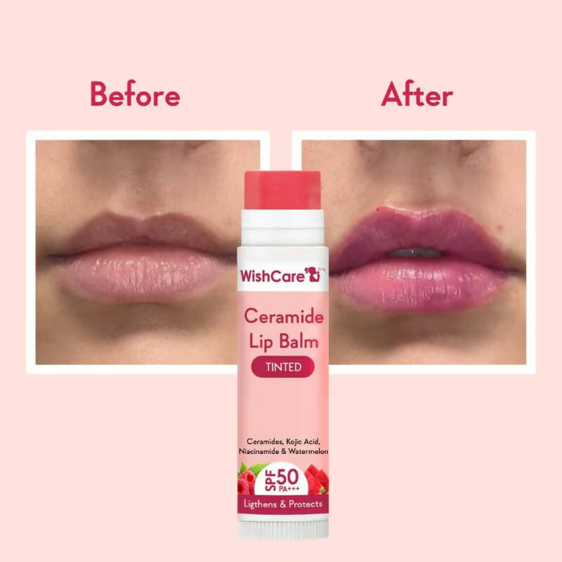 Wishcare Ceramide Lip Balm with SPF50 PA+++ - Tinted - Brightening Balm for Dark Lips with Kojic Acid & Niacinamide | Grocsy