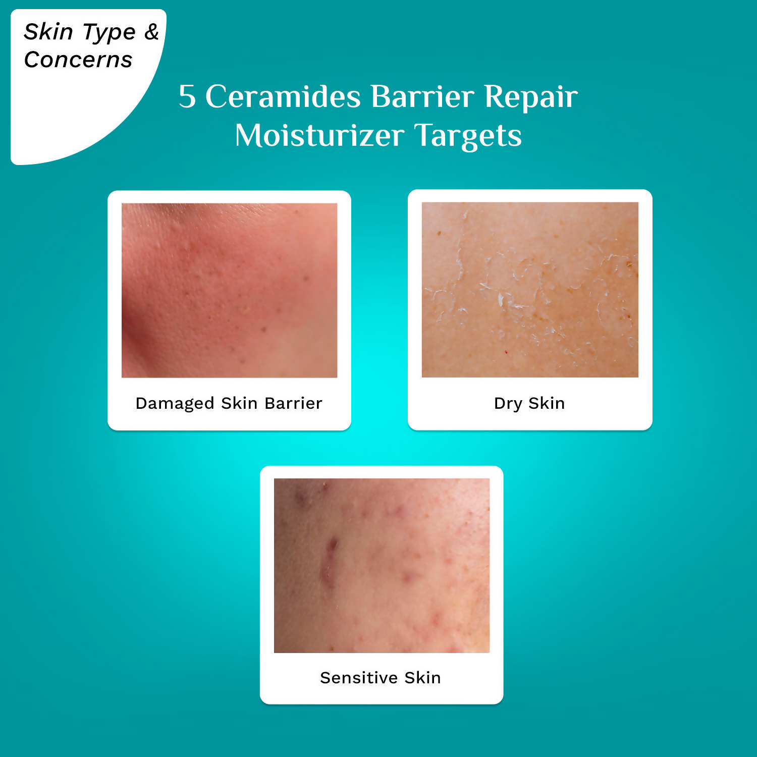 Pilgrim 5 Ceramides Barrier Repair Moisturizer | Grocsy