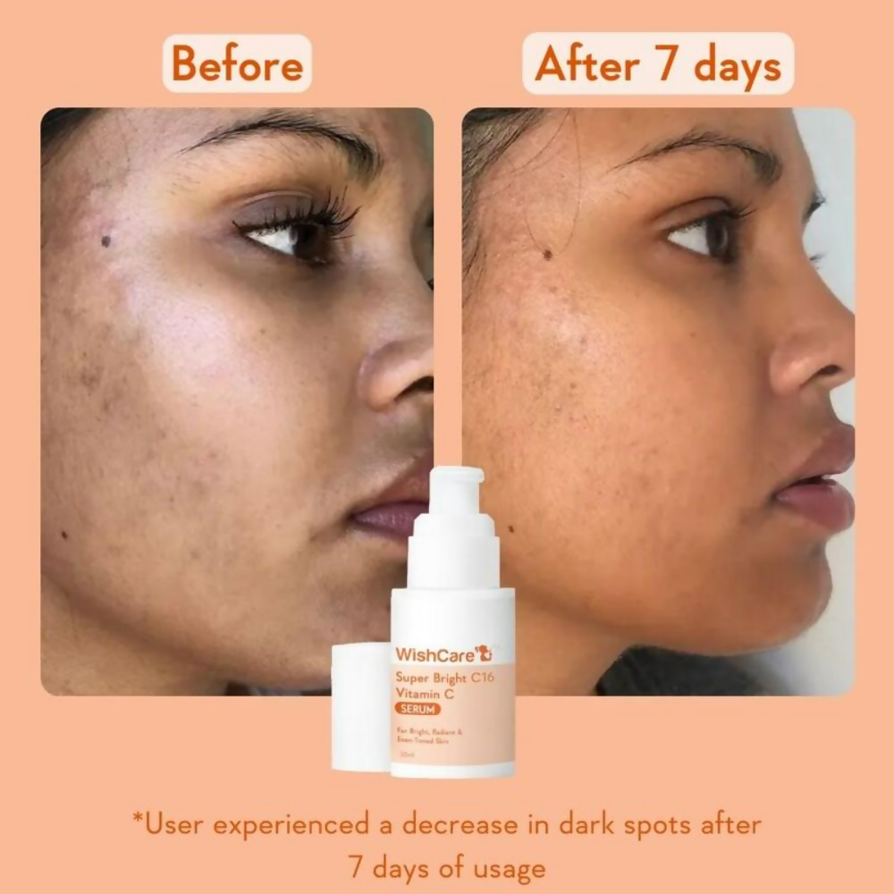 Wishcare Super Bright C16 Vitamin C Face Serum | Grocsy