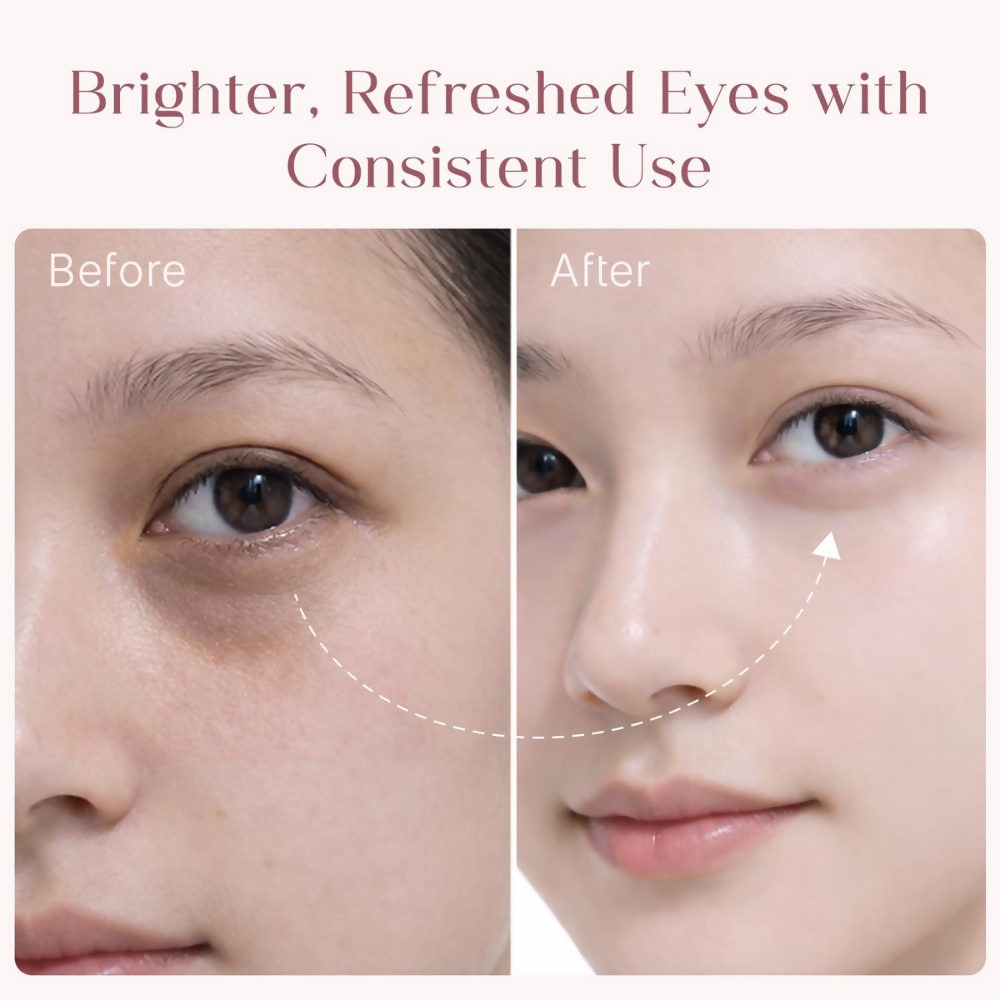 Seoulskin Under Eye Cream | Grocsy