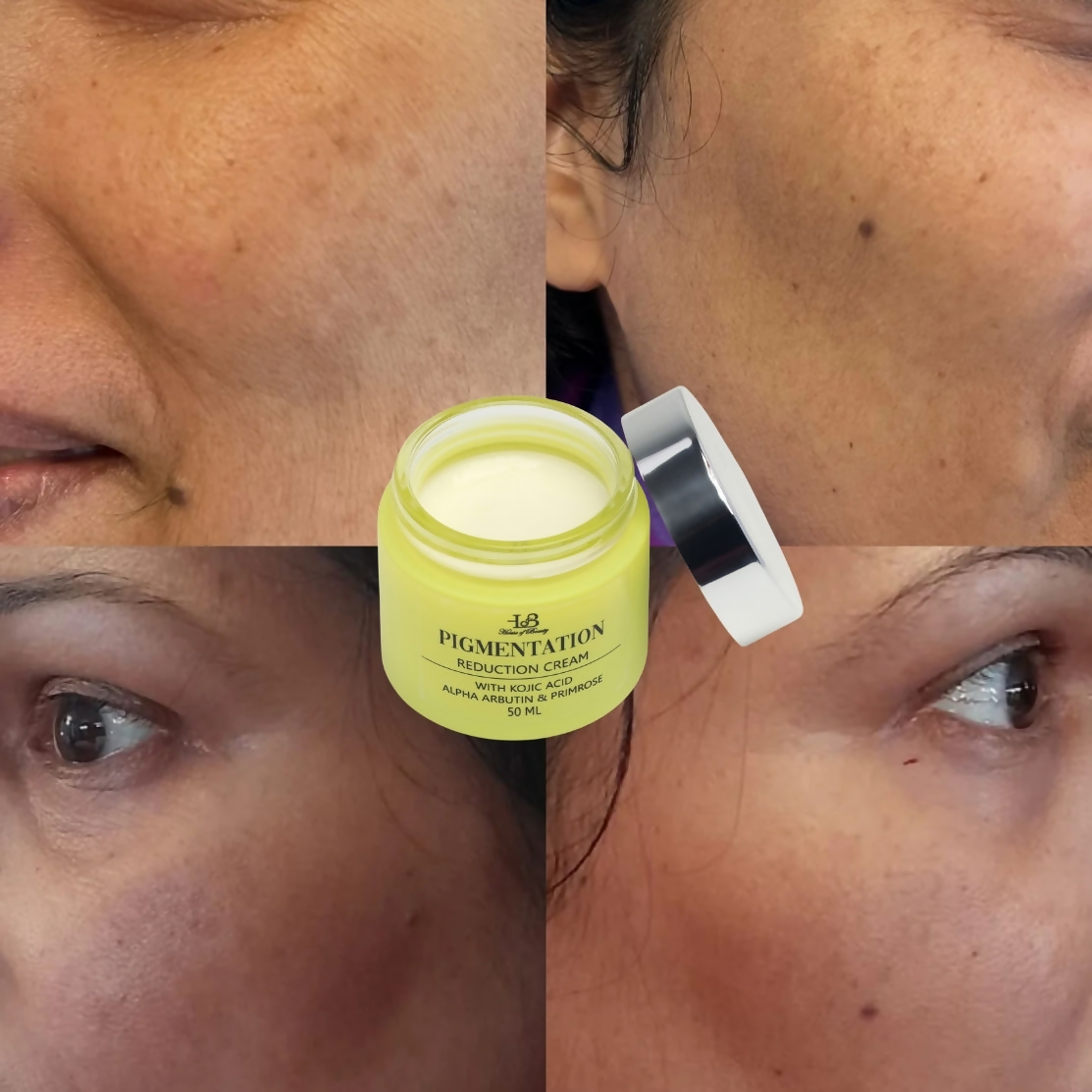 House of Beauty Pigmentation Reduction Cream | Grocsy