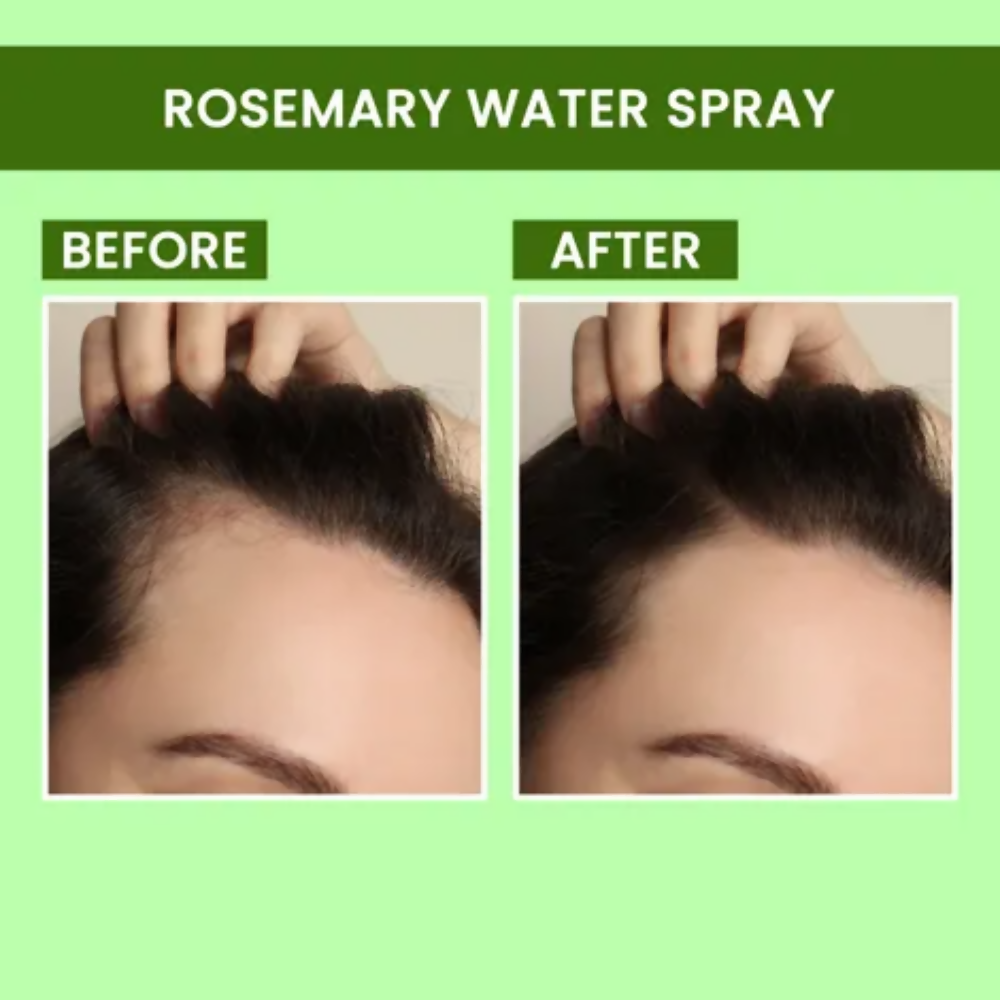 Alps Goodness X DERMDOC Bestselling Sprays Duo | Grocsy
