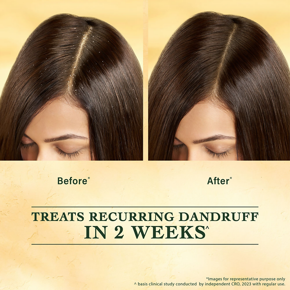 Indulekha Svetakutuja Dandruff Treatment Scalp Serum | Grocsy