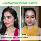 PLIX The Plant Fix Salicylic Acid Face Cleanser & Spot Corrector Gel Combo | Grocsy