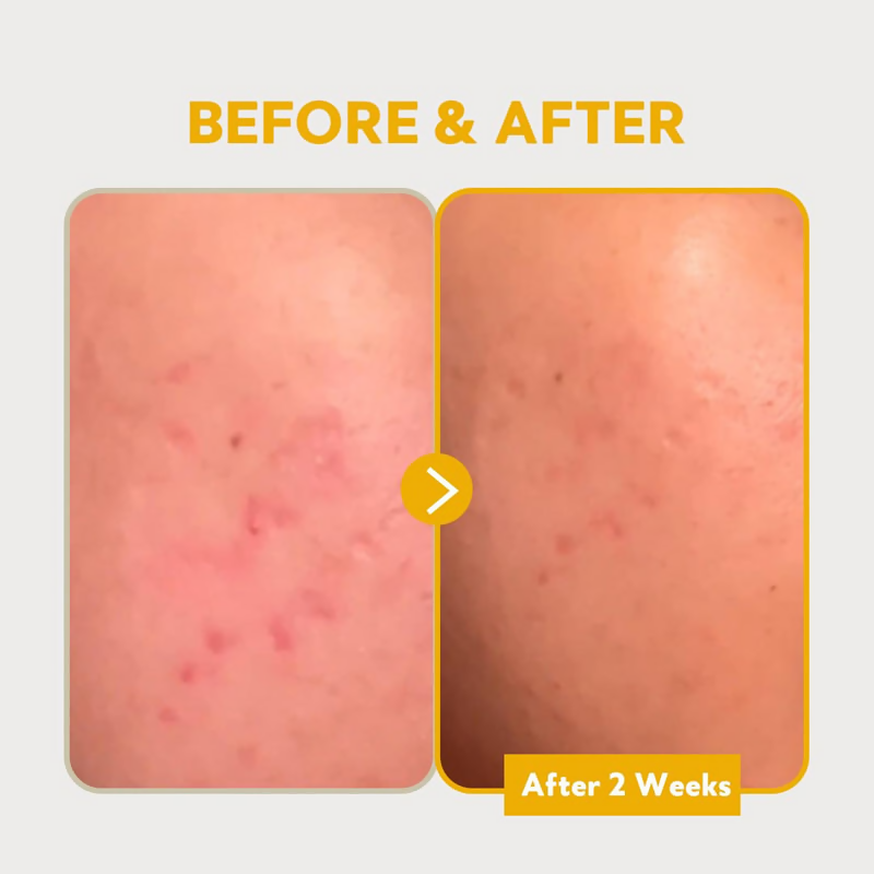 Tirtir Pure Vitamin C24 Serum | Grocsy