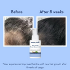 WishCare Hair Growth& Anti Hairfall Range with Serum, Shampoo & Conditioner Combo | Grocsy
