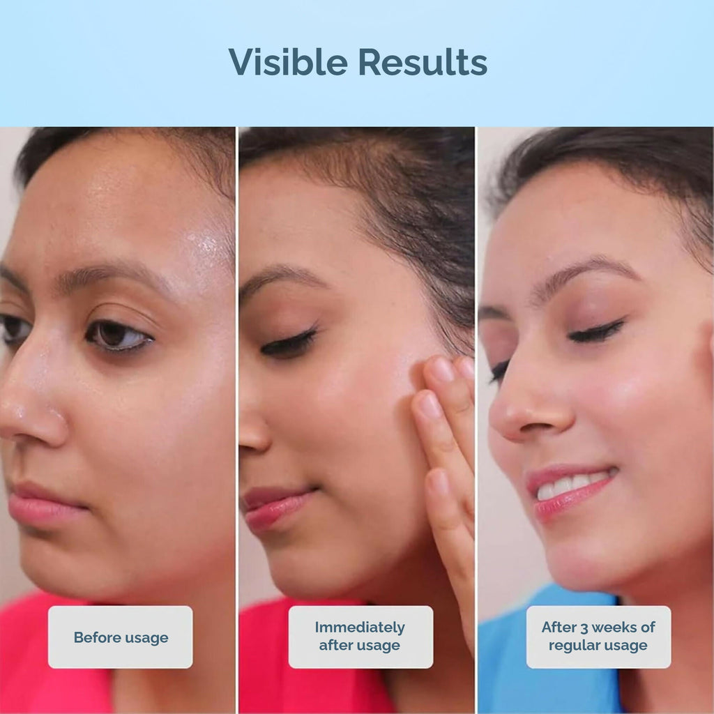 Cos-IQ AirGel NMF 15% for Oily Skin Moisturizer | Grocsy