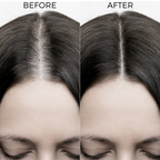 Brillare Onion & Bakuchiol Oil Shots For Hair Fall Reduction | Grocsy