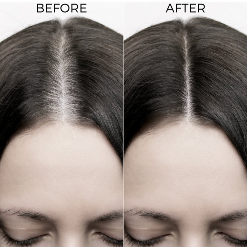 Brillare Onion & Bakuchiol Oil Shots For Hair Fall Reduction | Grocsy