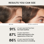 Ouai Scalp Serum | Grocsy