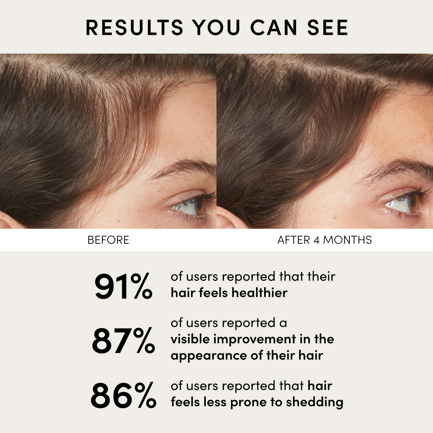 Ouai Scalp Serum | Grocsy