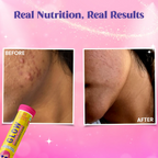 Chicnutrix Everyday Glow Combo - Glow & Outshine, Glutathione & Korean Brightening Serum | Grocsy
