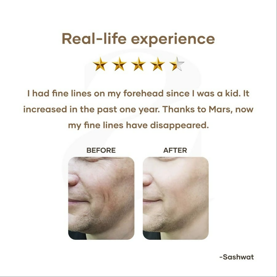 Mars By GHC Anti Aging Serum With Retinol | Grocsy