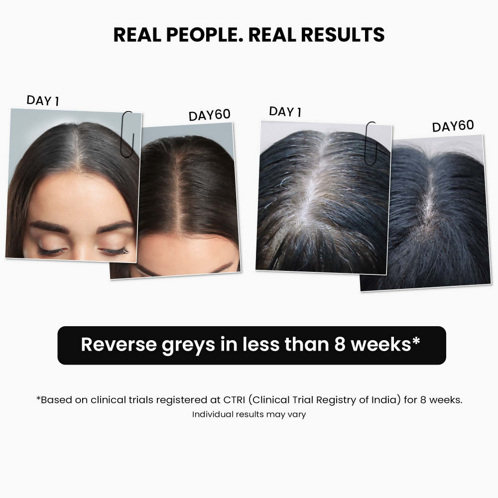 ThriveCo AntiGreying Hair Prime Serum - Reverses Premature Greying Colour | Grocsy