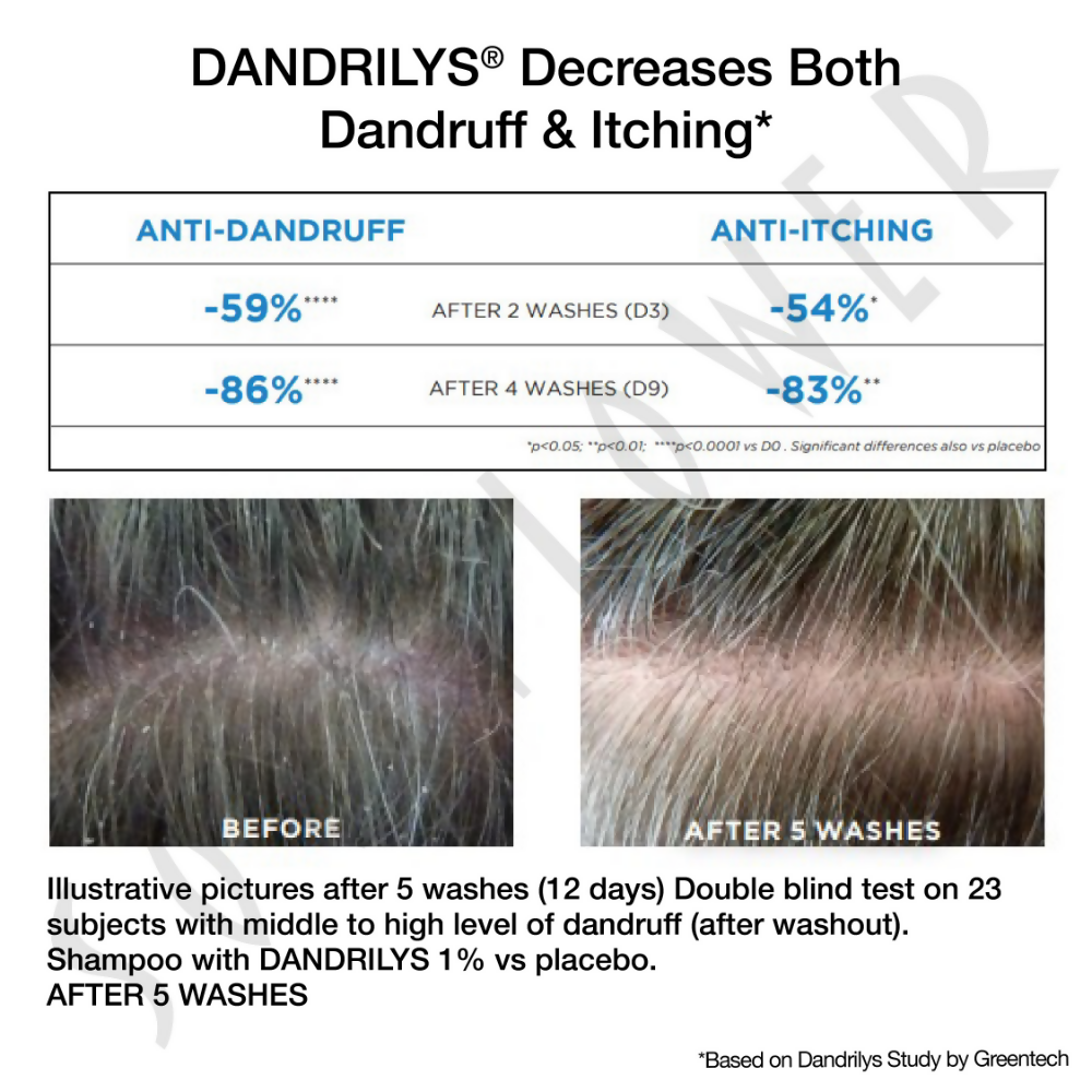 Soulflower Anti Dandruff Shampoo | Grocsy
