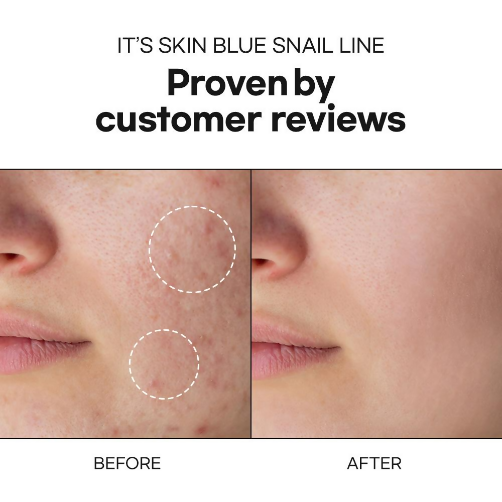 It's Skin Blue Snail Moisturizer | Grocsy